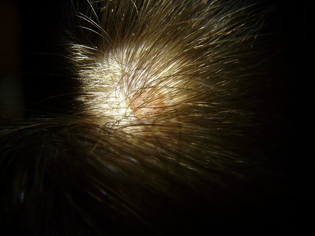 scalp